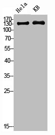 Western Blot analysis of HELA KB cells using PDGFR-beta Polyclonal Antibody Western Blot analysis of HELA KB cells using PDGFR-beta Polyclonal Antibody