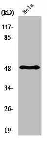 Western Blot analysis of Hela cells using PDK1 Polyclonal Antibody Western Blot analysis of Hela cells using PDK1 Polyclonal Antibody