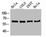 Western Blotting(WB) 2- PDPK1 Antibody