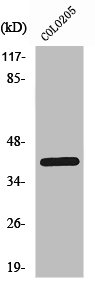 Western Blot analysis of COLO205 cells using PKAalpha/beta/gamma cat Polyclonal Antibody Western Blot analysis of COLO205 cells using PKAalpha/beta/gamma cat Polyclonal Antibody