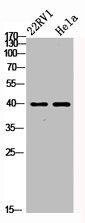Western Blot analysis of 22RV1 HELA cells using PKAalpha/beta/gamma cat Polyclonal Antibody
