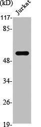 Western Blot analysis of Jurkat cells using SRE-ZBP Polyclonal Antibody Western Blot analysis of Jurkat cells using SRE-ZBP Polyclonal Antibody