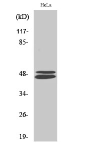 Western Blot analysis of Hela cells using VASP Polyclonal Antibody diluted at 1:500. Secondary antibody was diluted at 1:20000 Western Blot analysis of Hela cells using VASP Polyclonal Antibody diluted at 1:500. Secondary antibody was diluted at 1:20000