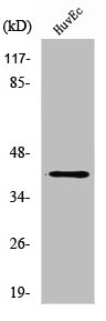 Western Blot analysis of COLO205 cells using ZADH2 Polyclonal Antibody Western Blot analysis of COLO205 cells using ZADH2 Polyclonal Antibody