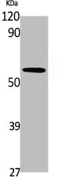 Western Blot analysis of K562 cells using A1BG Polyclonal Antibody Western Blot analysis of K562 cells using A1BG Polyclonal Antibody