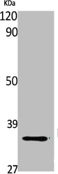 Western Blot analysis of Jurkat cells using FAIM2 Polyclonal Antibody