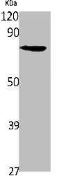 Western Blot analysis of 293 cells using SLC6A14 Polyclonal Antibody