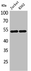 Western Blotting(WB) 1- HNF4A Antibody