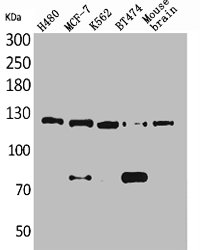 Western Blotting(WB) 1- NCAM1 Antibody