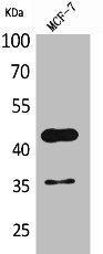 Western Blotting(WB) 1- ANGPTL4 Antibody