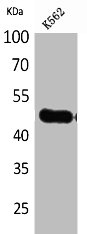 Western Blotting(WB) 1- IL5RA Antibody