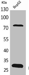 Western Blot analysis of HepG2 cells using DCI Polyclonal Antibody Western Blot analysis of HepG2 cells using DCI Polyclonal Antibody