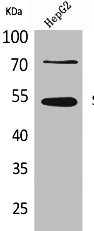 Western Blotting(WB) 1- SPTLC1 Antibody