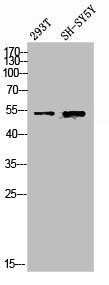 Western Blotting(WB) 2- SPTLC1 Antibody