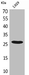 Western Blot analysis of L929 cells using CD159a/c Polyclonal Antibody Western Blot analysis of L929 cells using CD159a/c Polyclonal Antibody