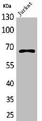 Western Blotting(WB) 1- ESR1 Antibody