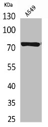 Western Blot analysis of A549 cells using p73 Polyclonal Antibody Western Blot analysis of A549 cells using p73 Polyclonal Antibody