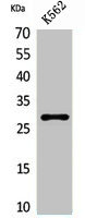 Western Blotting(WB) 1- APOA1 Antibody