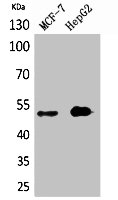 Western Blotting(WB) 1- LILRA1 Antibody