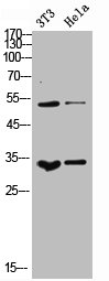 Western Blotting(WB) 2- CSF1 Antibody