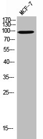 Western Blot analysis of MCF-7 cells using CD36 Polyclonal Antibody