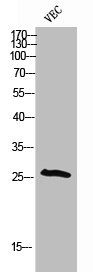 Western Blotting(WB) 1- Phospho-CDKN1B (T198) Antibody