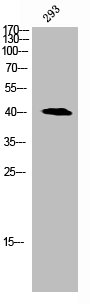 Western Blot analysis of 293 cells using C/EBP alpha Polyclonal Antibody Western Blot analysis of 293 cells using C/EBP alpha Polyclonal Antibody