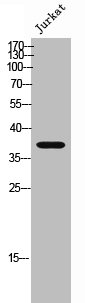 Western Blot analysis of Jurkat cells using Peropsin Polyclonal Antibody Western Blot analysis of Jurkat cells using Peropsin Polyclonal Antibody