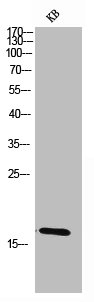 Western Blot analysis of KB cells using Choriogonadotropin beta Polyclonal Antibody