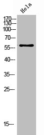 Western Blot analysis of Hela cells using Phospho-Chk2 (T383) Polyclonal Antibody Western Blot analysis of Hela cells using Phospho-Chk2 (T383) Polyclonal Antibody
