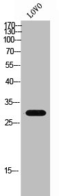 Western Blot analysis of LOVO cells using GPR146 Polyclonal Antibody Western Blot analysis of LOVO cells using GPR146 Polyclonal Antibody