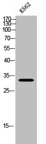 Western Blot analysis of K562 cells using CIB3 Polyclonal Antibody