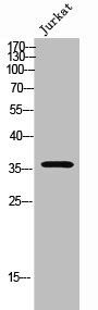 Western Blot analysis of Jurkat cells using Olfactory receptor 52E2 Polyclonal Antibody