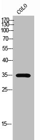 Western Blot analysis of COLO cells using Olfactory receptor 51A7 Polyclonal Antibody