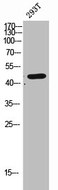 Western Blot analysis of 293T cells using CLN5 Polyclonal Antibody