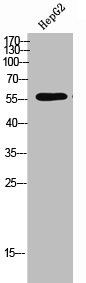 Western Blot analysis of HepG2 cells using Phospho-TPH2 (S19) Polyclonal Antibody
