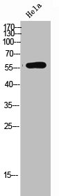 Western Blot analysis of HeLa cells using TPH2 Polyclonal Antibody