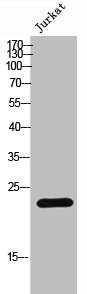 Western Blot analysis of Jurkat cells using JDP2 Polyclonal Antibody
