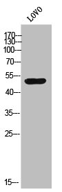 Western Blot analysis of lOVO cells using AR-alpha1A Polyclonal Antibody