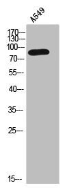 Western Blot analysis of A549 cells using Catenin-beta Polyclonal Antibody