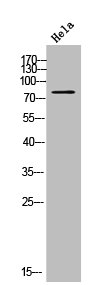 Western Blot analysis of HELA cells using CYP21A2 Polyclonal Antibody