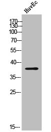 Western Blot analysis of HUVEC cells using CYP24A1 Polyclonal Antibody