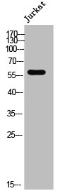 Western Blot analysis of Jurkat cells using ZNF596 Polyclonal Antibody Western Blot analysis of Jurkat cells using ZNF596 Polyclonal Antibody