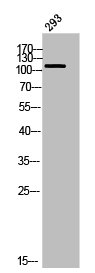 Western Blot analysis of 293 cells using Dsg1 Polyclonal Antibody