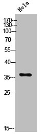 Western Blot analysis of HeLa cells using E2F-5 Polyclonal Antibody Western Blot analysis of HeLa cells using E2F-5 Polyclonal Antibody