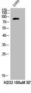 Western Blot analysis of LOVO+H2O2 cells using Phospho-Cortactin (Y421) Polyclonal Antibody Western Blot analysis of LOVO+H2O2 cells using Phospho-Cortactin (Y421) Polyclonal Antibody