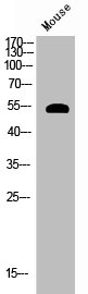 Western Blotting(WB) 1- Phospho-AKT1 (S124) Antibody