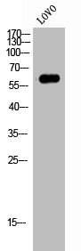 Western Blot analysis of LOVO cells using FoxJ1 Polyclonal Antibody Western Blot analysis of LOVO cells using FoxJ1 Polyclonal Antibody