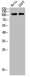 Western blot analysis of HELA 293T lysis using p52 S6 kinase antibody. Western blot analysis of HELA 293T lysis using p52 S6 kinase antibody.