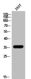Western Blot analysis of 293T cells using ApoE Polyclonal Antibody Western Blot analysis of 293T cells using ApoE Polyclonal Antibody